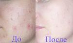 Тональный крем "Avon" Calming Effects Спокойное сияние фото