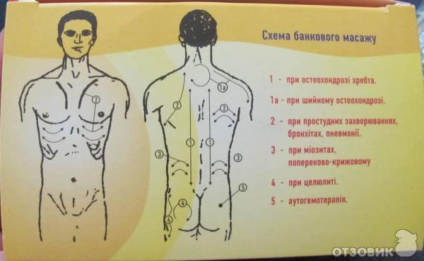 Куда ставить банки на тело. Схема постановки вакуумных банок. Баночный массаж спины схема вакуумный банками. Схемы постановки вакуумных магнитных банок. Точки для массажа вакуумными банками.